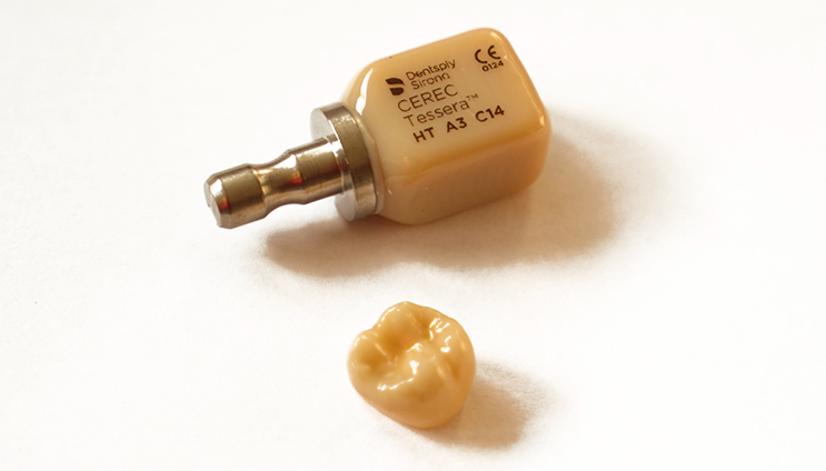 Zahnersatz, Praxis Dr. Nora Makki, Essen Borbeck Zahnersatz, Praxis Dr. Nora Makki, Essen Borbeck